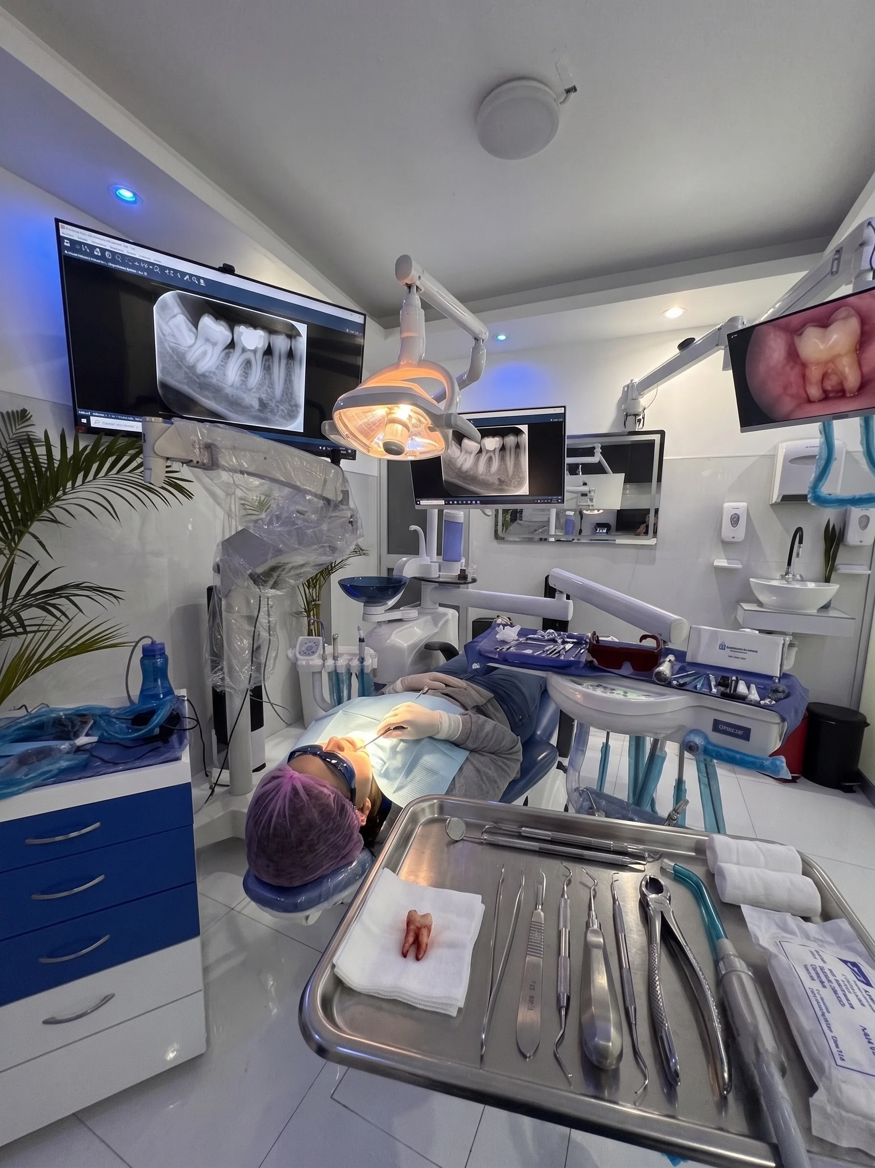Después de una extracción dental: dolor esperado, sangrado y signos de complicación